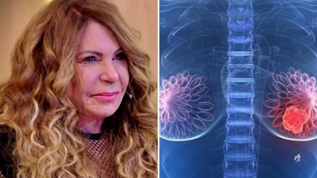 Médico alerta sobre câncer diagnosticado em Elba Ramalho: “Um dos mais”