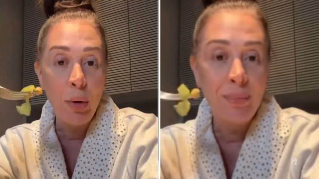 Claudia Raia sofre grave acidente e fratura é confirmada