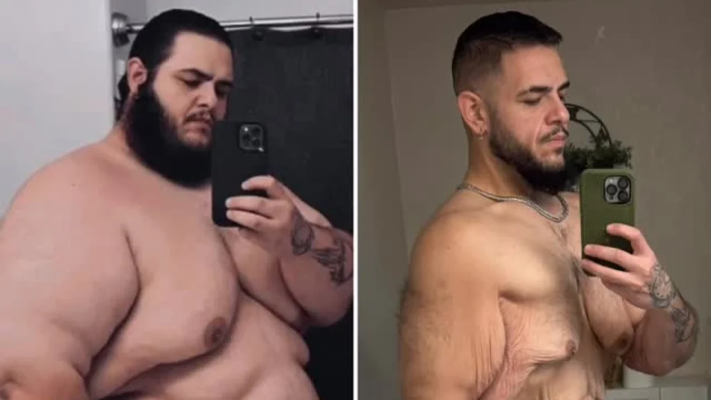 Influenciador viraliza ao perder 136 quilos e remover mais 7 de pele