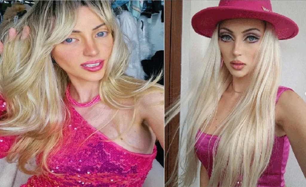 “Barbie Humana”: defensor entrega ter tentado reanimar influencer por 9 minutos