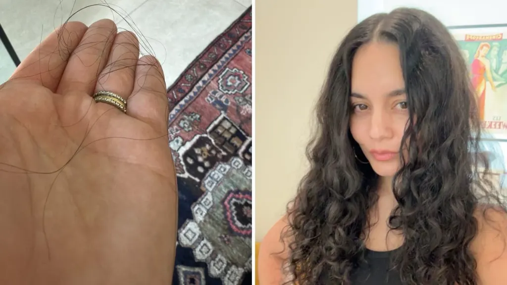 Vanessa Hudgens mostra queda capilar pós-parto: “E assim começa”