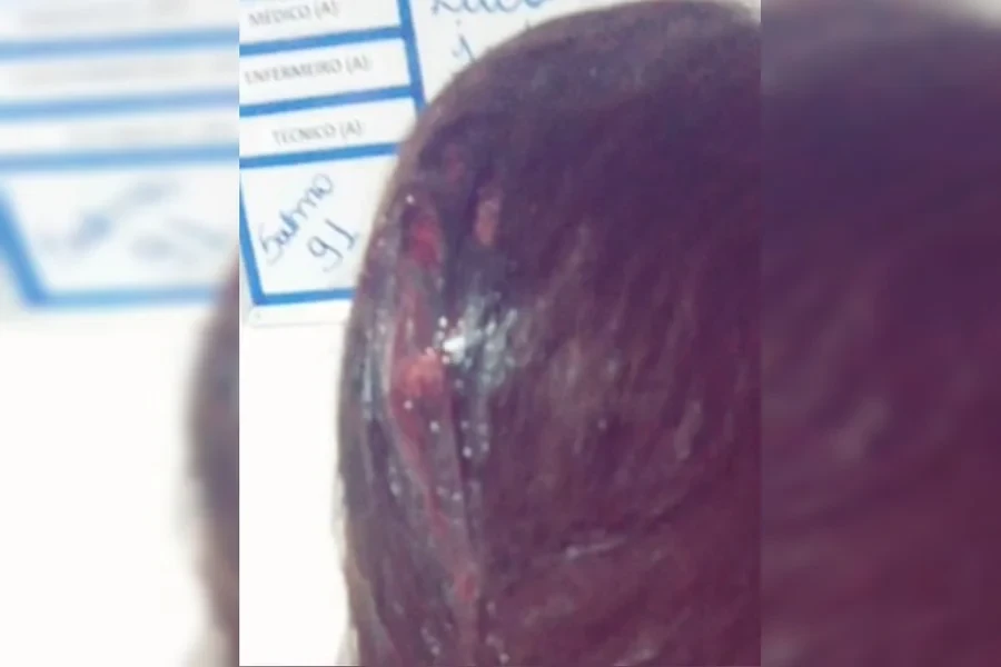Mulher é apedrejada e foge de agressor no DF: “Vou te matar”